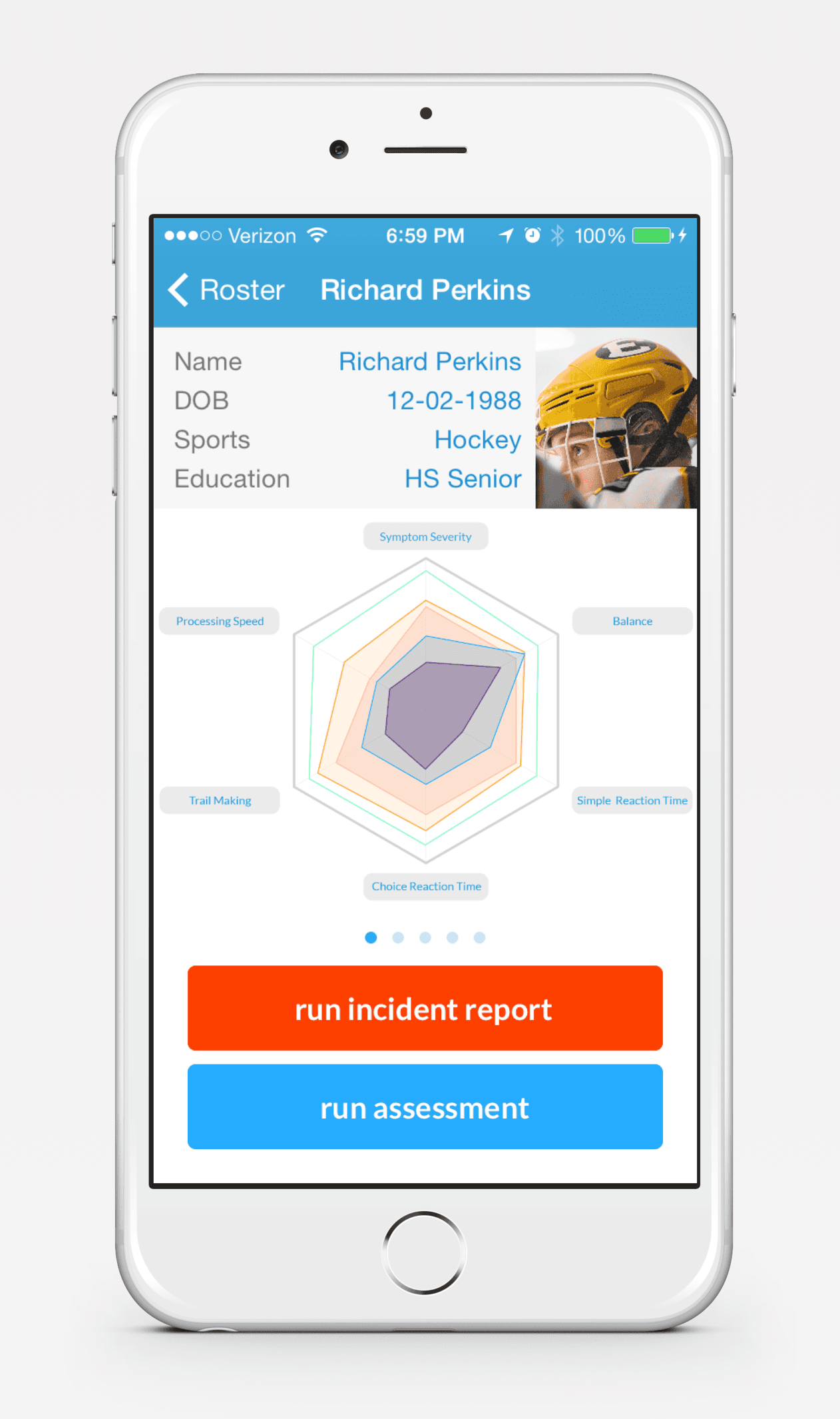 Concussion for iPhone