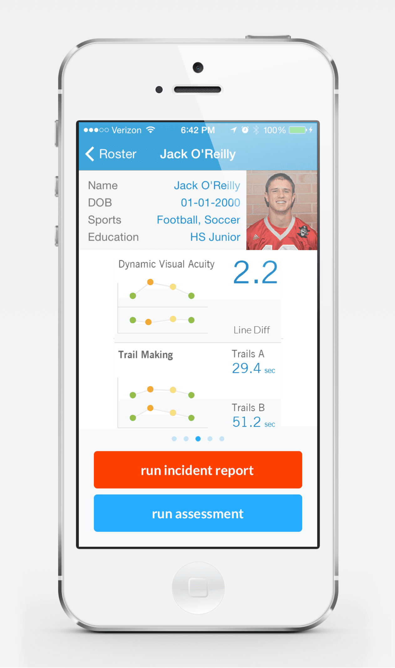 Concussion for iPhone